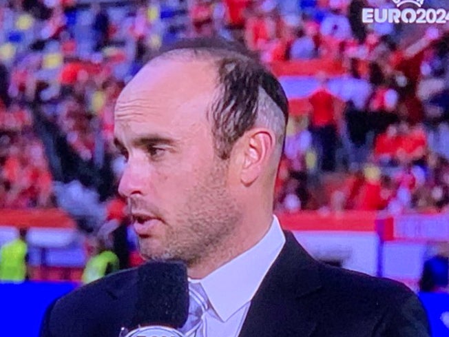 Best of 2024 - Landon Donovan's Hair Transplant Is Coming In Great, Why Do You Ask? (Bonus: His Texts Where He Realizes The World Saw The Disaster)